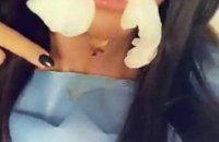 Aurélie Dotremont dévoile son visage tuméfié après deux nouvelles opérations de chirurgie esthétique