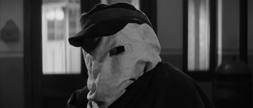 "Elephant Man" (1981) "Elephant Man" (1981)