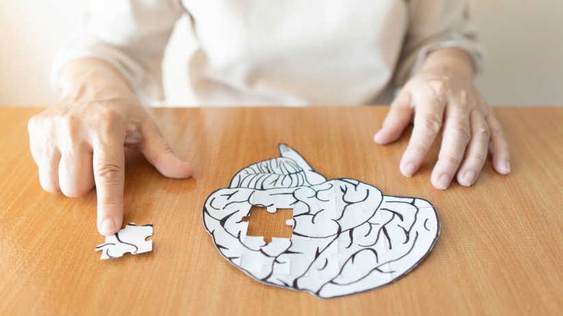 La maladie d'Alzheimer La maladie d'Alzheimer