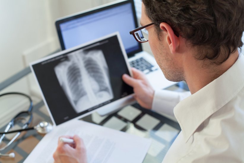 La fibrose pulmonaire idiopathique La fibrose pulmonaire idiopathique