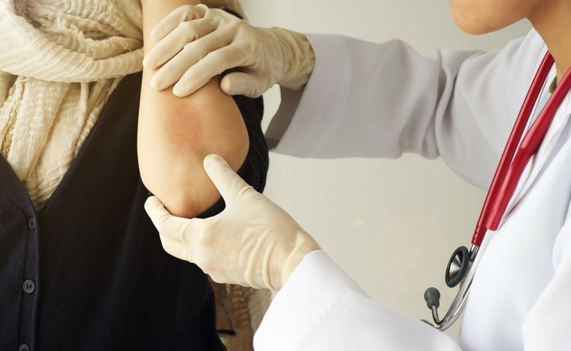 L'eczéma, la plus fréquente L'eczéma, la plus fréquente