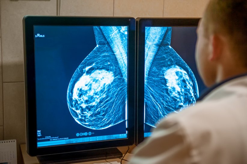 Plusieurs clichés de la poitrine sont nécessaires Plusieurs clichés de la poitrine sont nécessaires