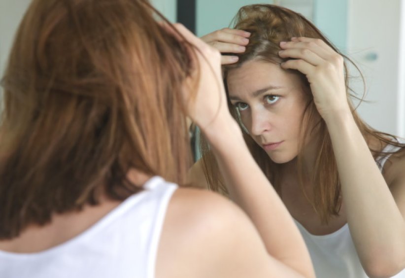 L'alopécie est une simple chute de cheveux L'alopécie est une simple chute de cheveux