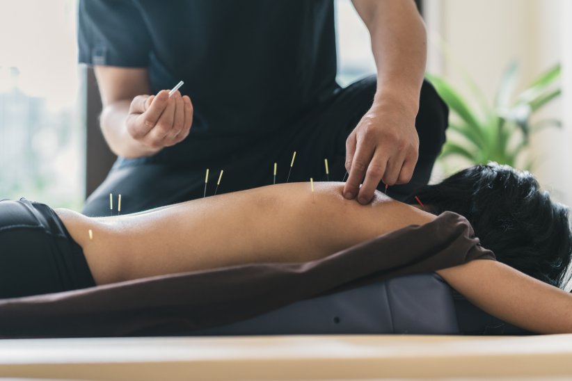 Les points d'acupuncture Les points d'acupuncture