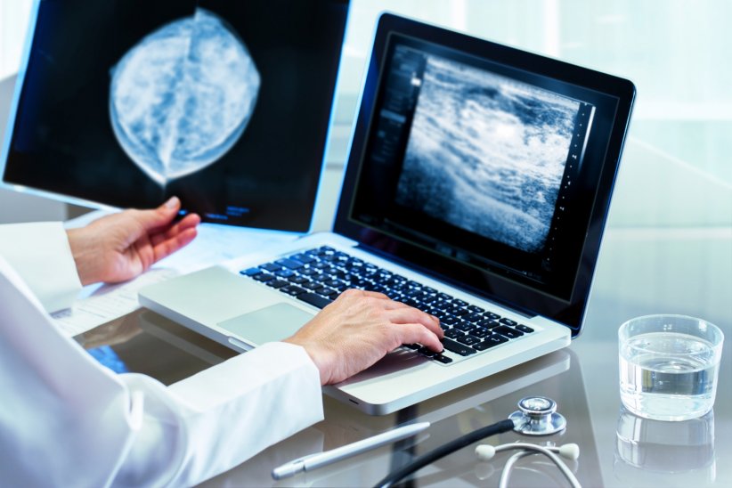 Ce qu'il ne faut pas faire avant une mammographie Ce qu'il ne faut pas faire avant une mammographie
