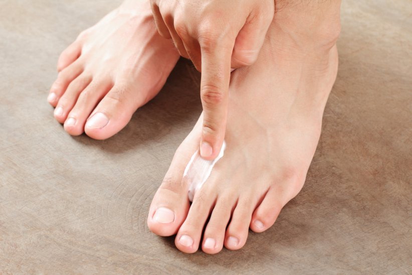 Le pied d'athlète Le pied d'athlète