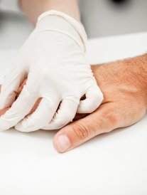 Verrues : comment s'en débarrasser définitivement ?