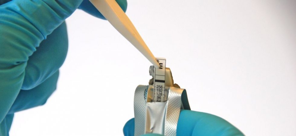 bioMérieux annonce le marquage CE de VIDAS SARS-COV-2 IgG II