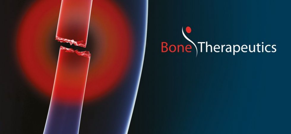 Bone Therapeutics : perte d'exploitation estimée à 15 ME