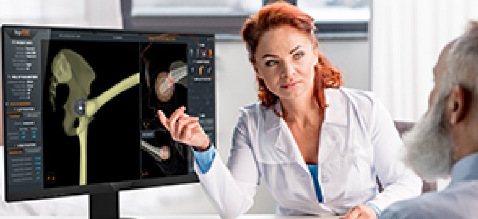 EOS Imaging : Alphatec pointe à plus de 90% du capital