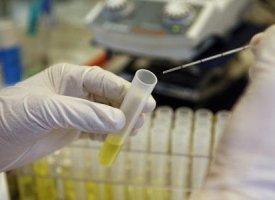 Transgene : les prochaines rencontres avec les investisseurs