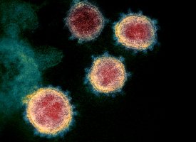 Hydroxychloroquine : trois auteurs de l'étude du Lancet se rétractent !