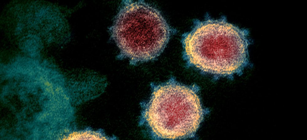 MedinCell avance dans son traitement contre la Covid-19