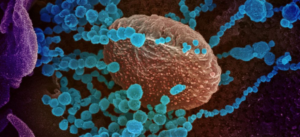 MedinCell : "pas d'obstacle à la prescription de l'ivermectine contre la Covid-19"