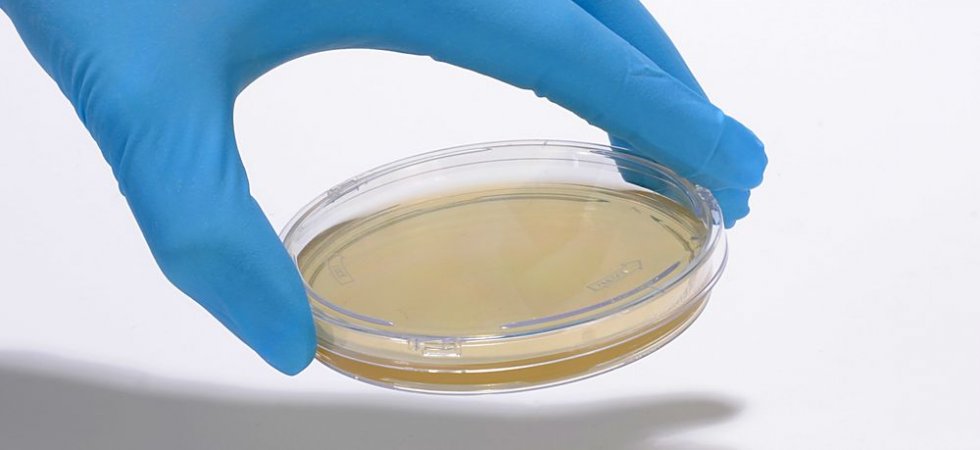 bioMérieux : haut perché