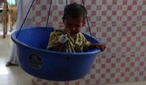 Inde: plus de 40 millions d'enfants souffrent de malnutrition