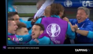 Euro 2016 : Belgique - Italie, Antonio Conte finit le nez en sang en célébrant le premier but italien (Vidéo)
