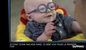 Un bébé atteint d'une maladie rare voit pour la première fois (vidéo)