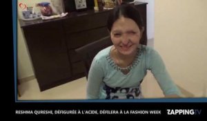 New-York : Défigurée à l'acide, une jeune indienne défilera pour la Fashion Week (Vidéo)