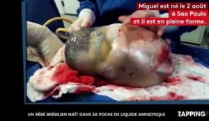 Un bébé brésilien naît dans son sac de liquide amniotique