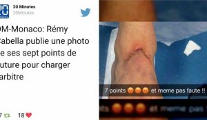 OM-Monaco: Rémy Cabella publie une photo de ses sept points de suture pour charger l'arbitre