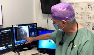 Le CHU de Lille se lance dans l’angioplastie virtuelle