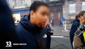 «Gilets jaunes» à Strasbourg: Un adolescent blessé au visage - ZAPPING ACTU DU 14/01/2019