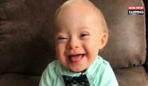Atteint de trisomie 21, cet enfant a été élu "plus beau bébé de 2018" (Vidéo)