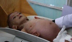 Yémen: des millions de civils en situation de pré-famine
