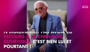 Charles Aznavour mort : pourquoi il s'était fait opérer du nez
