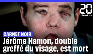 Mort de Jérôme Hamon, l’homme aux deux greffes de visage