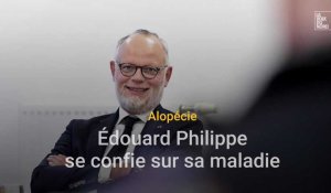 Alopécie, Édouard Philippe se confie sur sa maladie