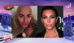 Le zapping du 19/12 : Il dépense 190.000 euros pour ressembler à Kim Kardashian