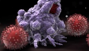 l'immunothérapie: une autre arme contre le cancer