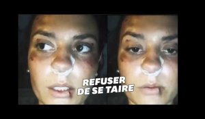 Nîmes: agressée en plein centre-ville, elle ne veut plus "avoir honte"