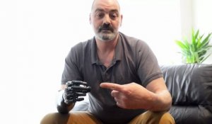 Nigel Ackland et son bras Bionic Terminator