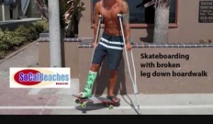 Skateboarding with Broken Leg Down Boardwalk