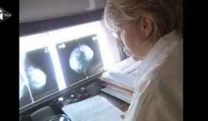 Cancer du sein : un dépistage avant 50 ans ?J
