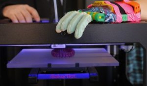 Cinq innovations médicales réalisées grâce à l’impression 3D