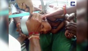 Inde: Intervention risquée pour libérer la tête d'un garçon coincée dans une cocotte-minute