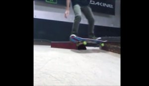 Skateboard fail : très douloureux!