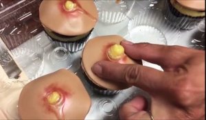Des cupcakes en forme de boutons d'acné !