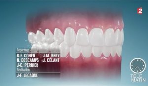Santé - Le fil dentaire : pour ou contre ?