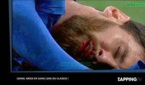 Lionel Messi le visage en sang après un coup de coude de Marcelo lors du Clasico (Vidéo)