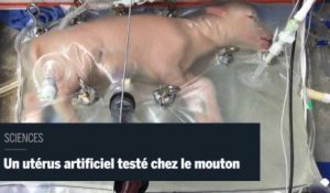 Sciences : un utérus artificiel testé chez le mouton