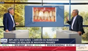 Les nouveaux progrès en matière d'implantologie dentaire grâce au numérique – 27/04