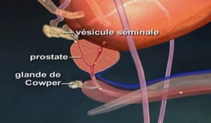 L'hyperplasie bénigne de la prostate expliquée en vidéo