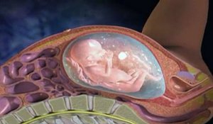 L'amniocentèse expliquée en vidéo