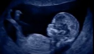 Voyage in utero - le 2e mois