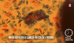 Santé - Mieux dépister le cancer du col de l’utérus